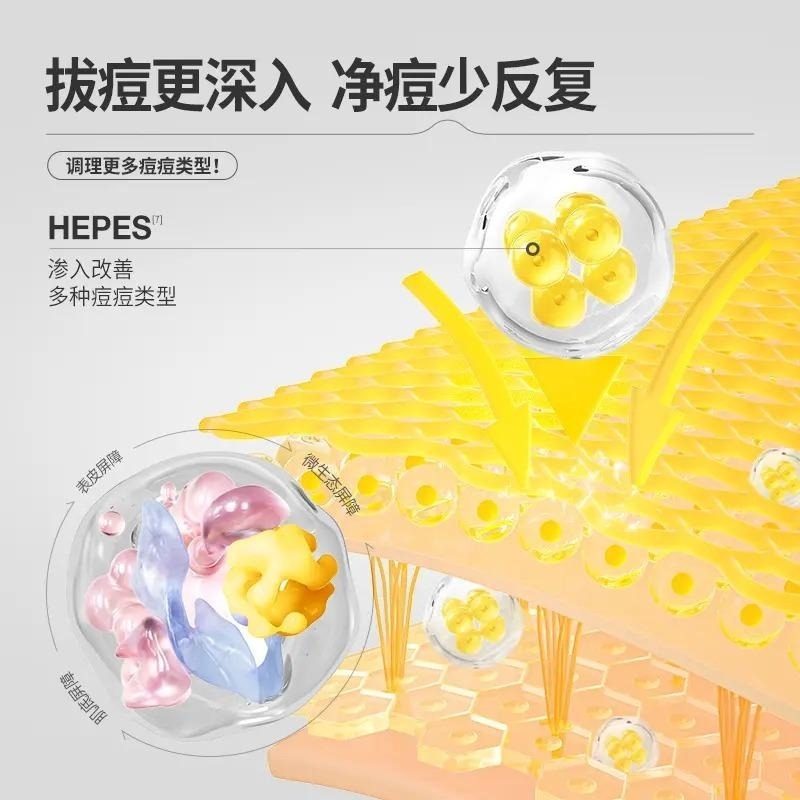 🖐全館免運🚚【適合油痘皮】羽素祛痘大燈泡第二代升級版膠態硫無酸快速祛痘 七老闆 七老板 三只羊 瘋狂小楊哥 推薦-細節圖2