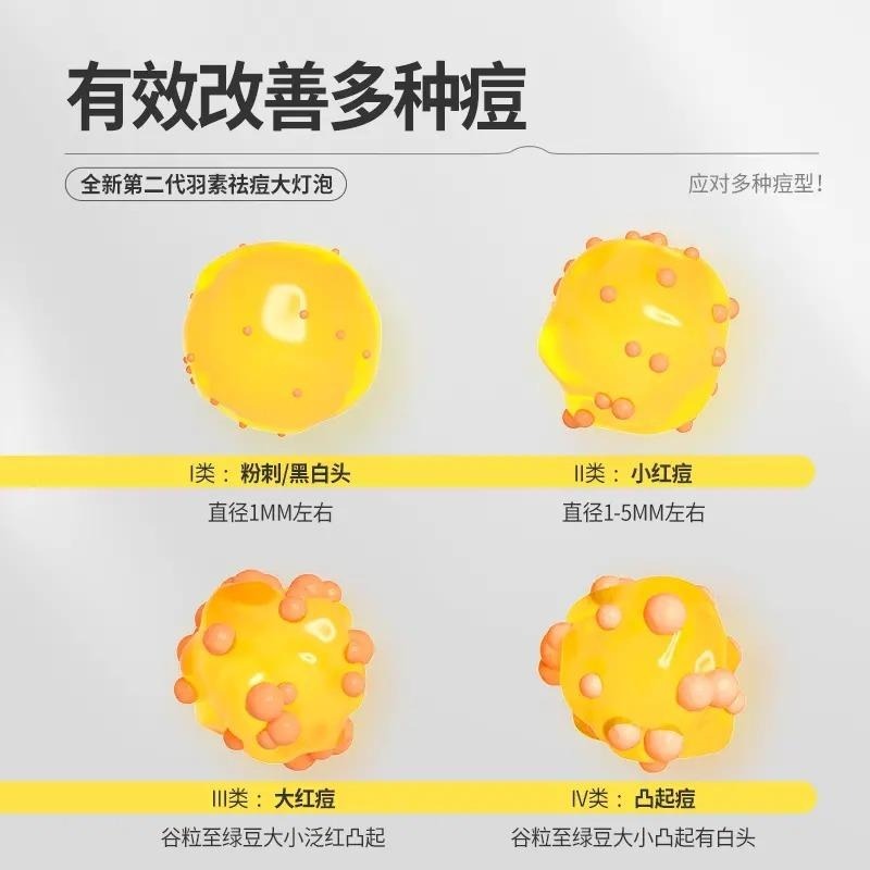 🖐全館免運🚚【適合油痘皮】羽素祛痘大燈泡第二代升級版膠態硫無酸快速祛痘 七老闆 七老板 三只羊 瘋狂小楊哥 推薦-細節圖3