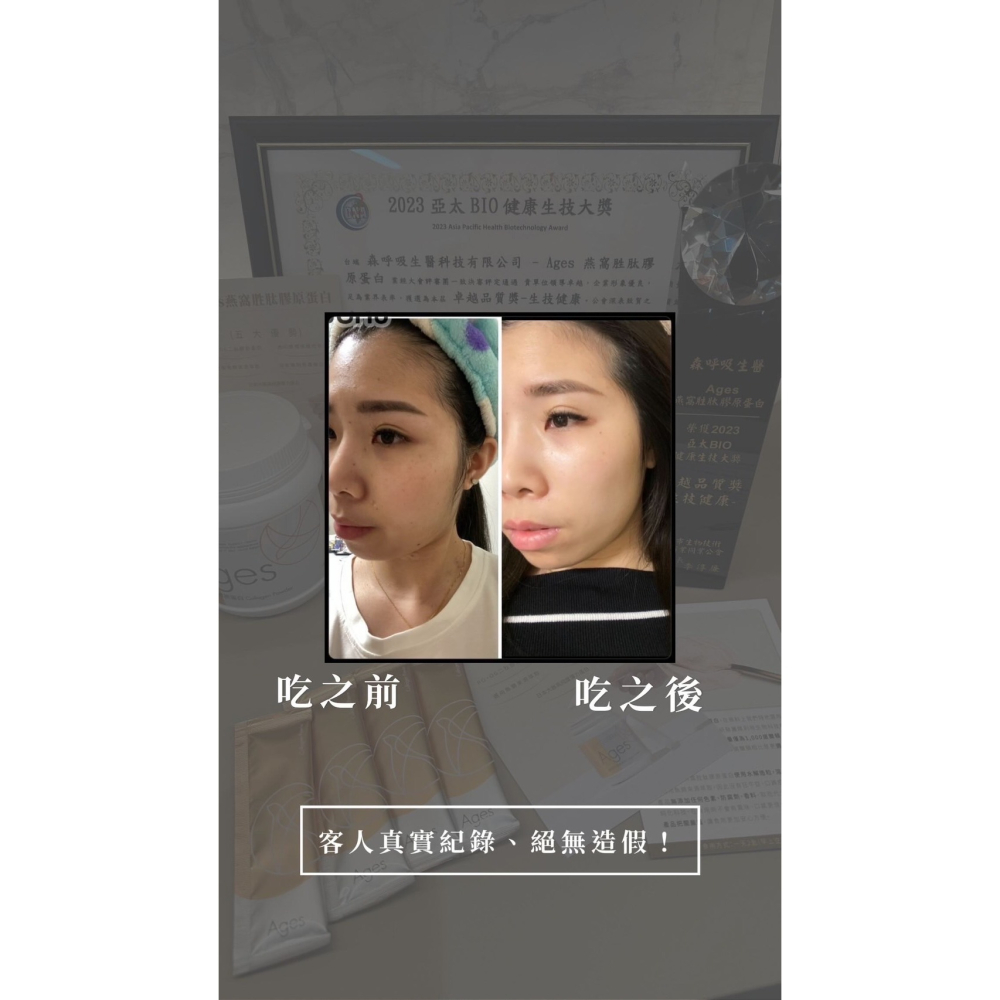 棻棻保養必備｜台灣品質保證金像獎｜亞太生技得獎｜Ages燕窩胜肽膠原蛋白盒裝｜日本彈力蛋白｜保證無腥味｜小分子吸收高效率-細節圖9