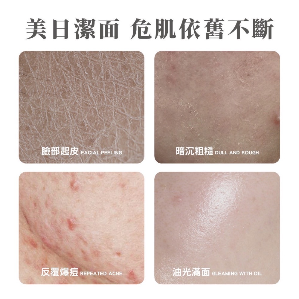 ⭐️現貨快速出貨⭐️ 日本🇯🇵胺基酸淨透美肌潔面乳100g-細節圖5