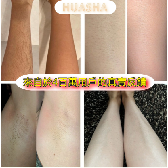 【限時下殺】保固一年 免運 台灣現貨 Air3 U-like 藍寶石 脫毛 腿毛 腋毛 私處 唇毛 家用 除毛原廠保固-細節圖6