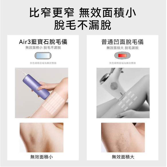【限時下殺】保固一年 免運 台灣現貨 Air3 U-like 藍寶石 脫毛 腿毛 腋毛 私處 唇毛 家用 除毛原廠保固-細節圖7