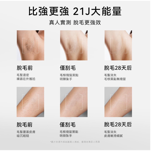 【限時下殺】保固一年 免運 台灣現貨 Air3 U-like 藍寶石 脫毛 腿毛 腋毛 私處 唇毛 家用 除毛原廠保固-細節圖8