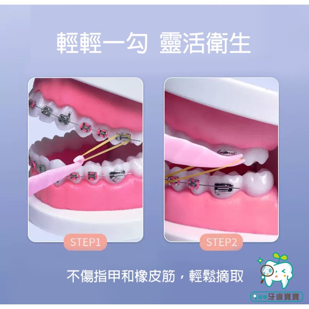 矯正專用 橡皮圈放置鈎一入 掛鈎-細節圖2