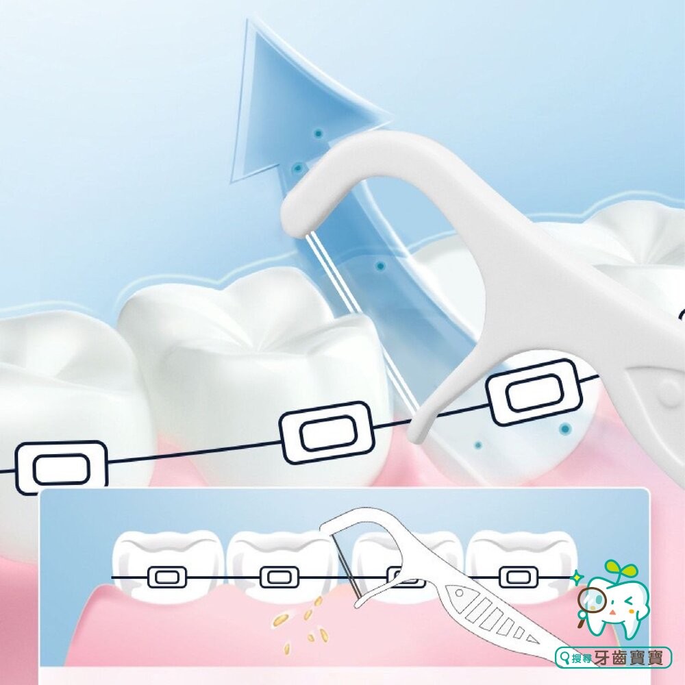 ORTHODONTIC FLOSS PICK 矯正專用牙線棒100支/袋裝 矯正牙線棒-細節圖5