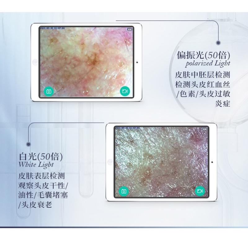 【優惠活動】現貨 M-13 頭皮檢測儀 理髮店 毛囊 毛髮 皮膚 平板 手機 雙鏡頭 高清 美容美髮 測試儀 皮膚檢測儀-細節圖6