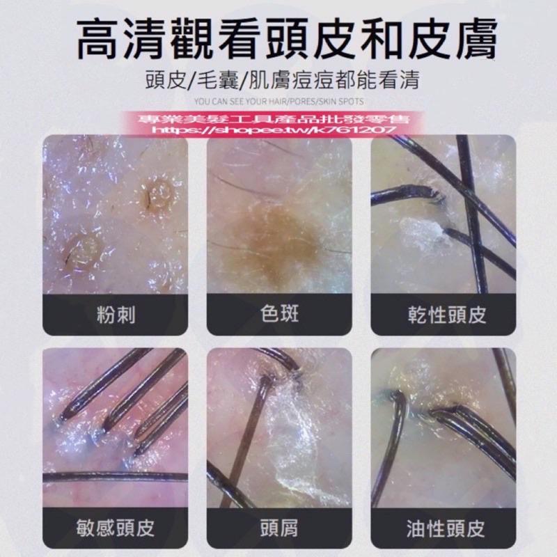 【廠商直銷】台灣現貨 無線 頭皮檢測儀 美容檢測儀 高清 手機 平板 毛囊 毛髮檢測儀 皮膚 頭皮儀-細節圖6