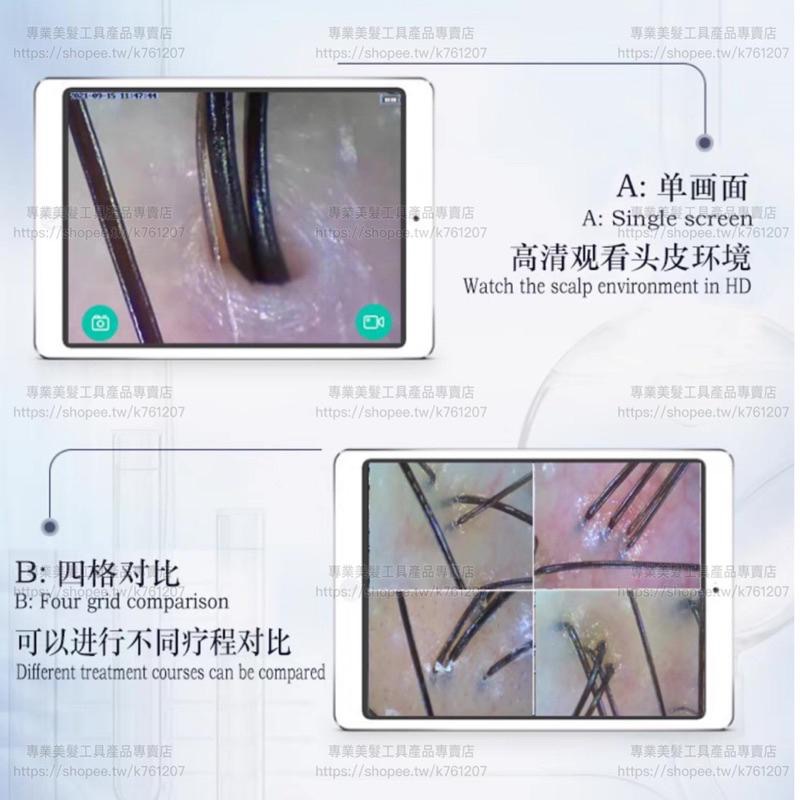 【廠商直銷】台灣現貨 無線 頭皮檢測儀 美容檢測儀 高清 手機 平板 毛囊 毛髮檢測儀 皮膚 頭皮儀-細節圖7