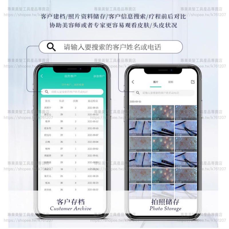 【廠商直銷】台灣現貨 無線 頭皮檢測儀 美容檢測儀 高清 手機 平板 毛囊 毛髮檢測儀 皮膚 頭皮儀-細節圖8