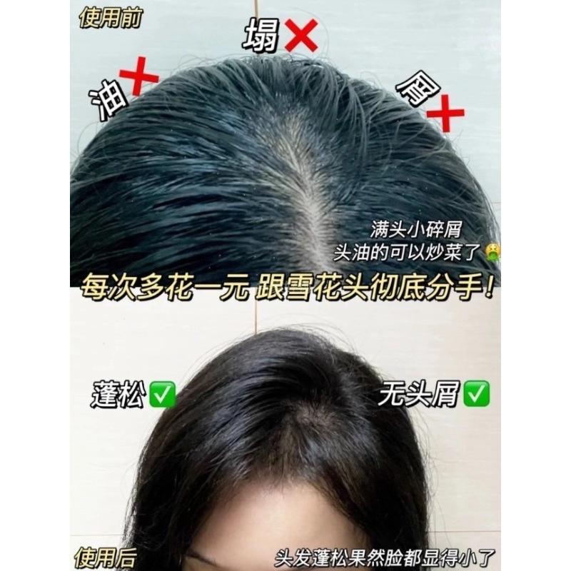 KERASTASE 卡詩 極淨平衡 頭皮 去角質｜凝露 200ml 頭皮 護理 即期-細節圖4