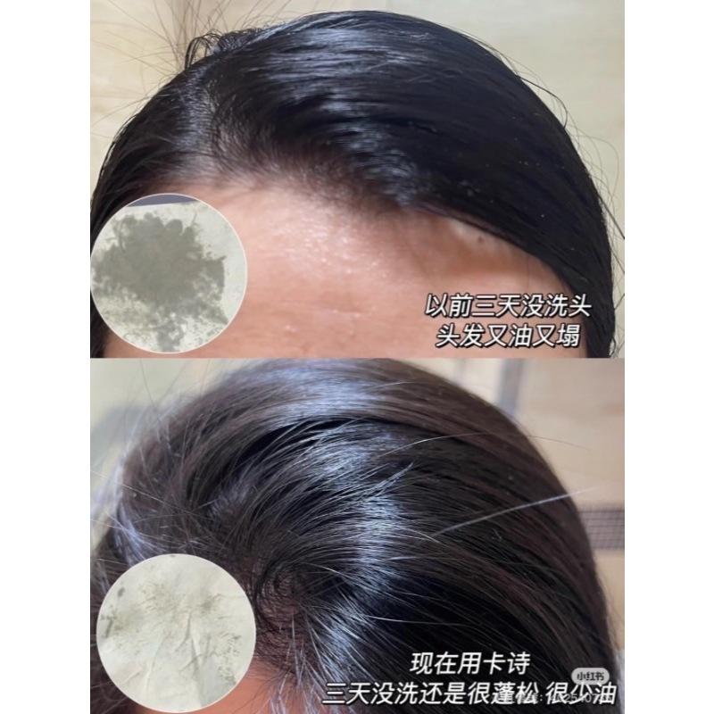 KERASTASE 卡詩 極淨平衡 頭皮 去角質｜凝露 200ml 頭皮 護理 即期-細節圖5