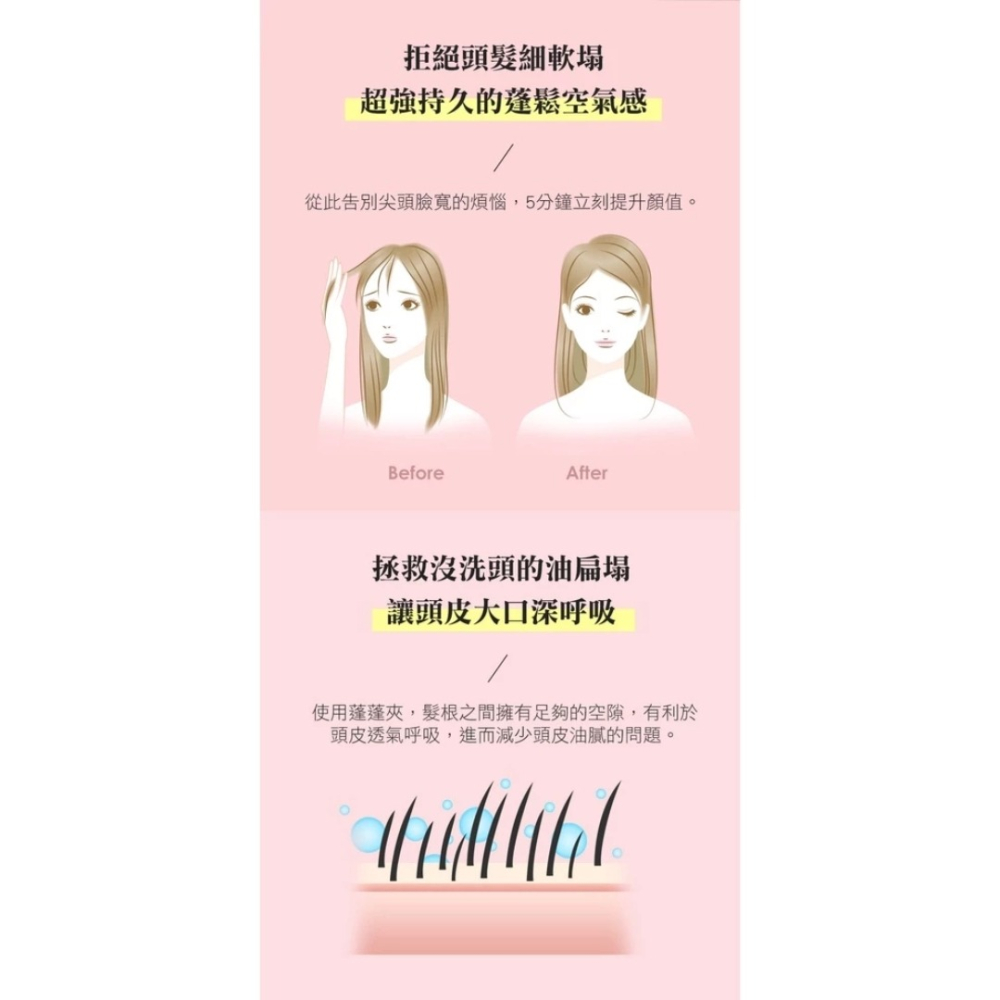 開發票 Pingo 品工 Royal K9外噴式負離子蓬蓬夾 (1支入) 多色供選-細節圖6