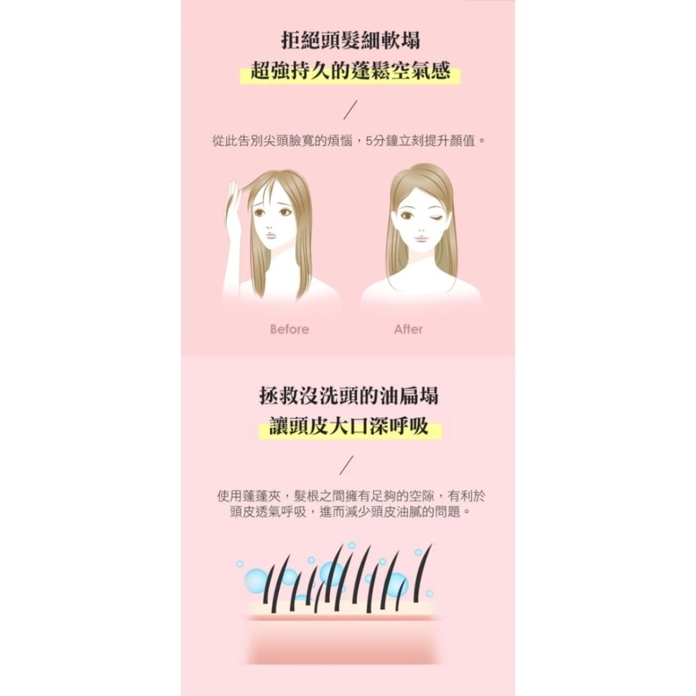 開發票 Pingo 品工 Royal K9外噴式負離子蓬蓬夾 (1支入) 多色供選-細節圖6