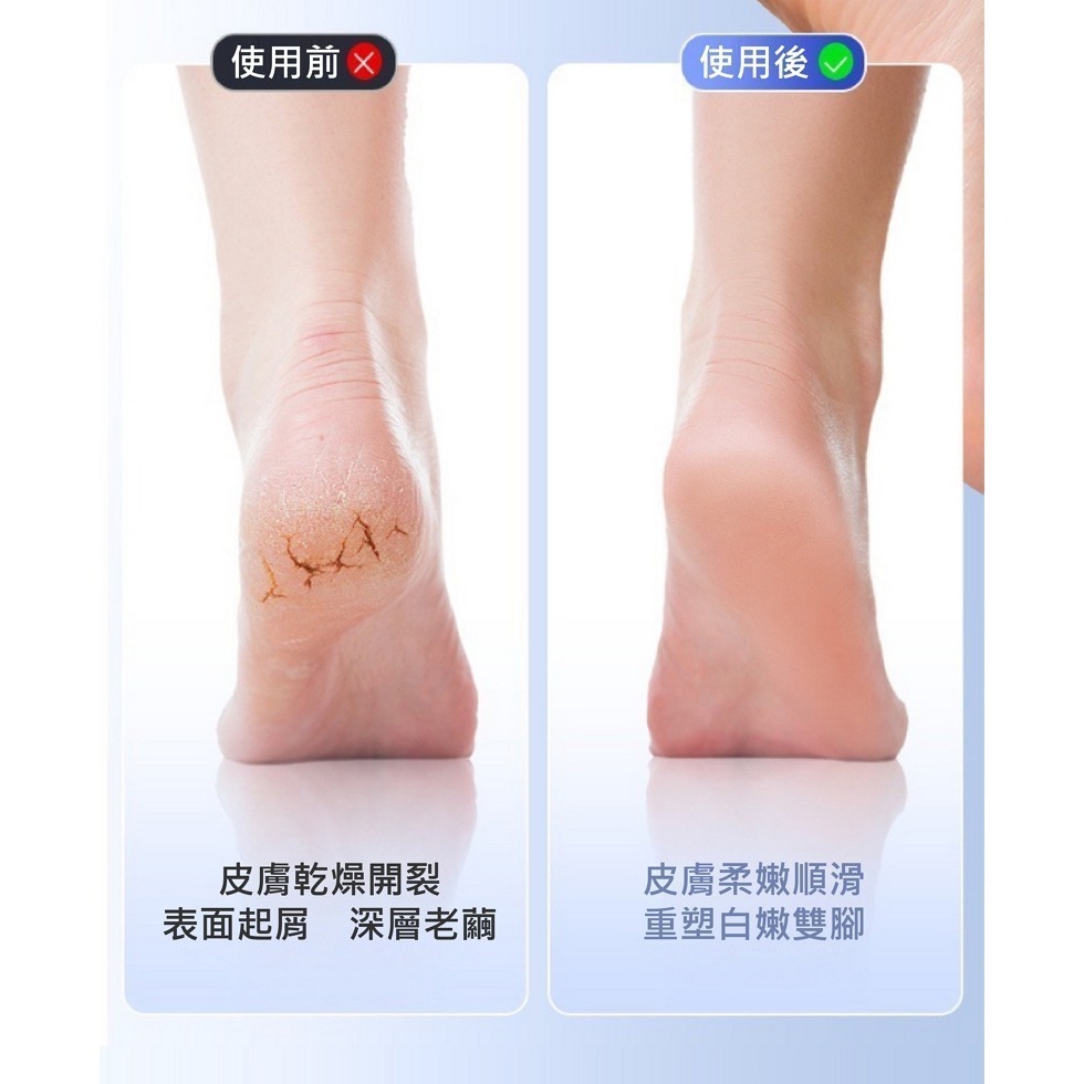 【限時購】新款智能電動磨腳器去死皮全自動修足器-細節圖7