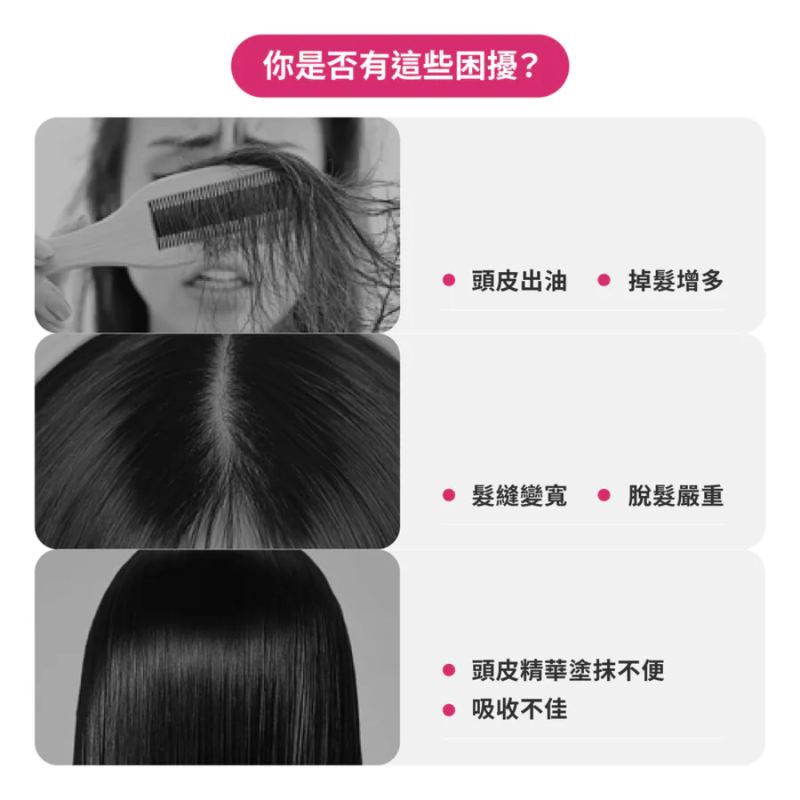 TYMO TRITHERA 紅光按摩梳-細節圖3