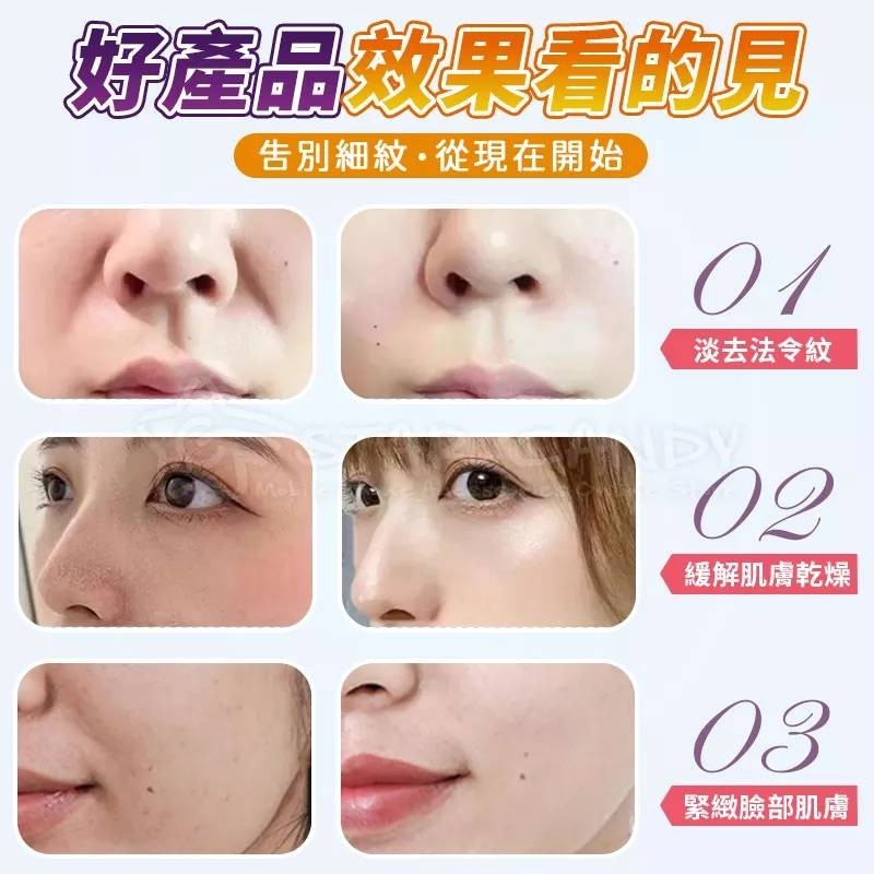 💖樂福科技💖 法令紋緊緻膜 法令紋貼 緊致抗皺淡化細紋 眼膜貼 面膜 眼膜 水凝膠面膜 美妝 保養-細節圖7