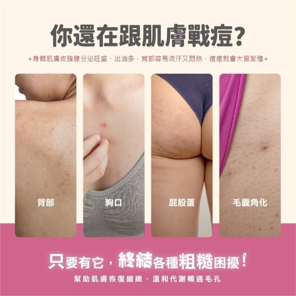 ❤️‍🩹出清潔洛美JAROME 2%BHA水楊酸煥膚身體乳-細節圖2