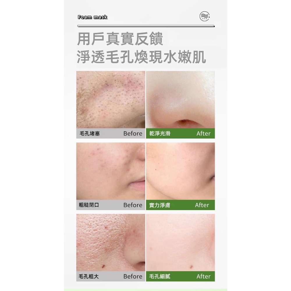 買一送一複合酸牛油果深層清潔泡泡面膜-細節圖4