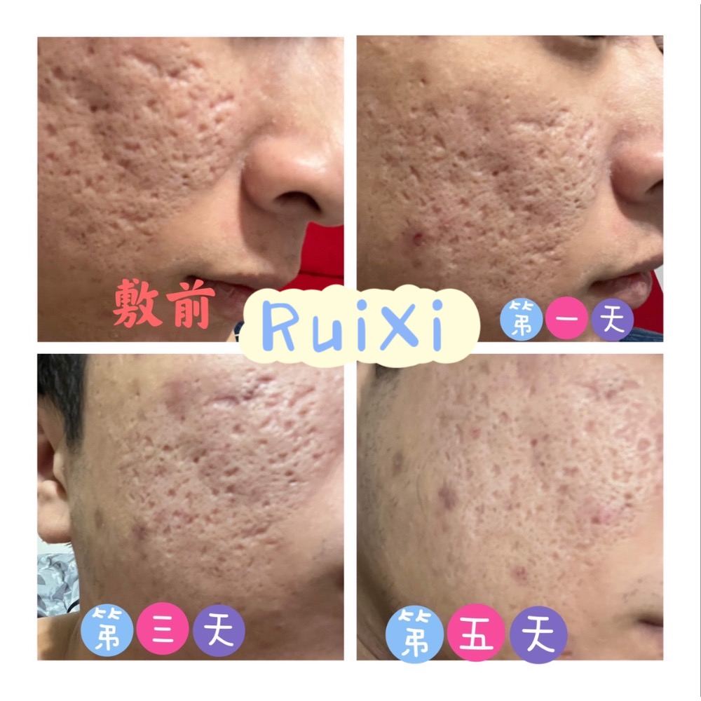 RuiXi 💦鎖水磁石亮澤面膜➰現貨供應-細節圖4