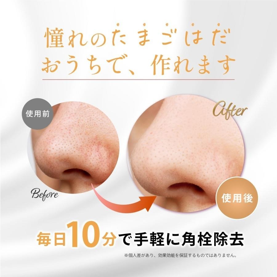 日本 毛穴堂 黑頭粉刺護理全套組 工具8件組 鑷子組-細節圖3