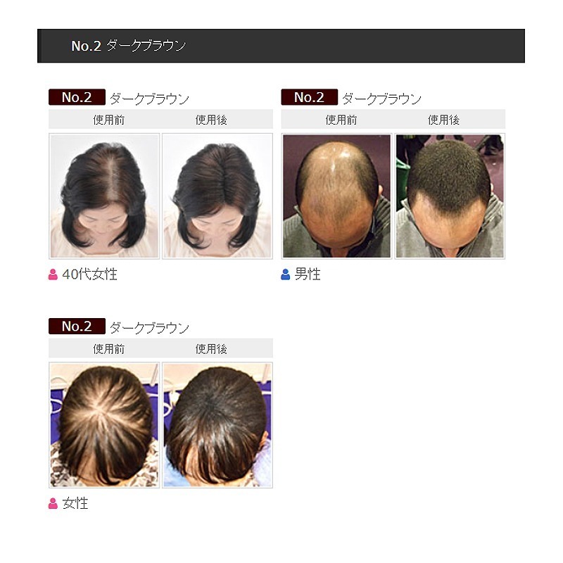 日本SMH 超級神奇天然纖維髮絲 髮粉 大容量30g-細節圖4
