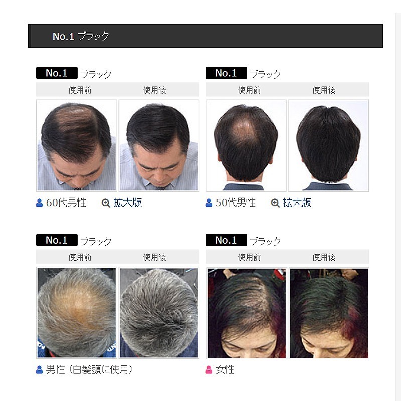 日本SMH 超級神奇天然纖維髮絲 髮粉 大容量30g-細節圖6