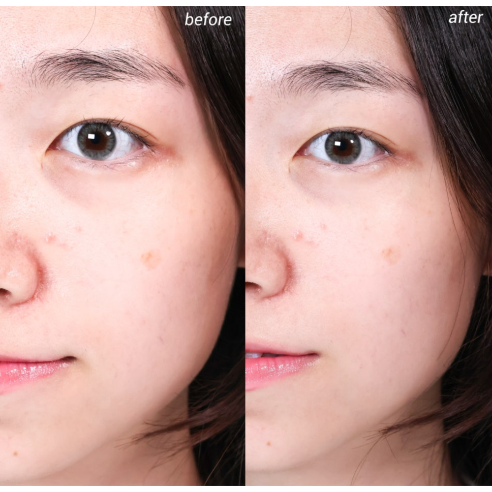 🇰🇷 韓國Fillimilli 冷卻冰涼 按摩儀 不插電消腫美容儀-細節圖3