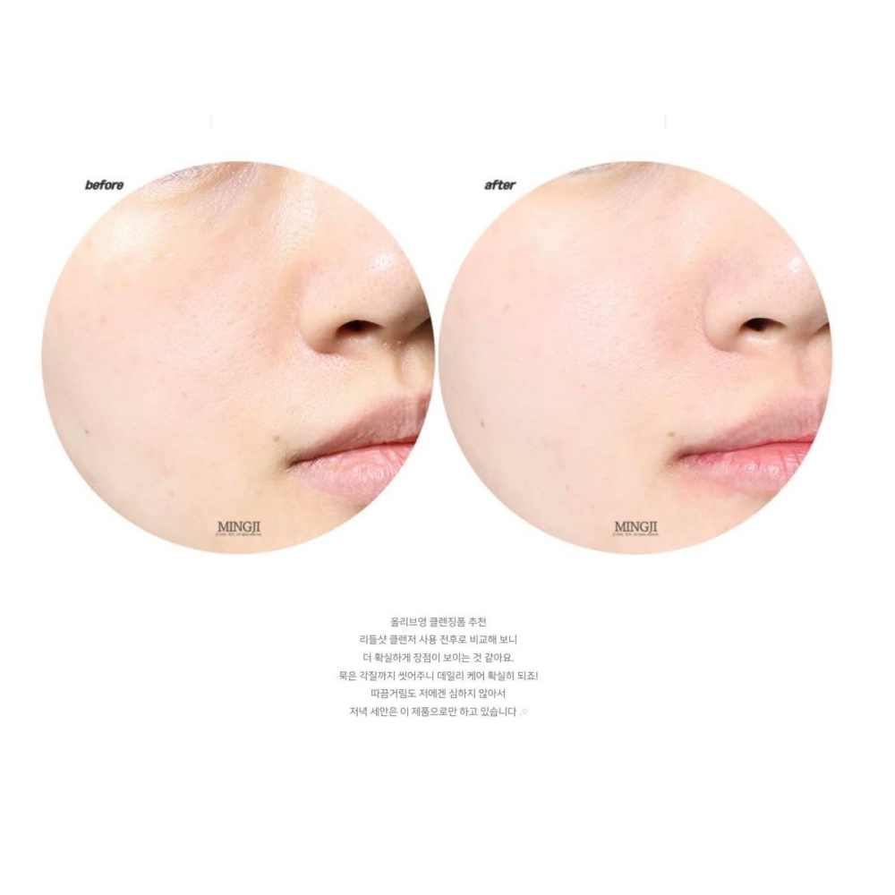 🇰🇷 韓國超有感好用 VT #積雪草微針精華🪡 洗面乳 #溫和角質護理-細節圖2