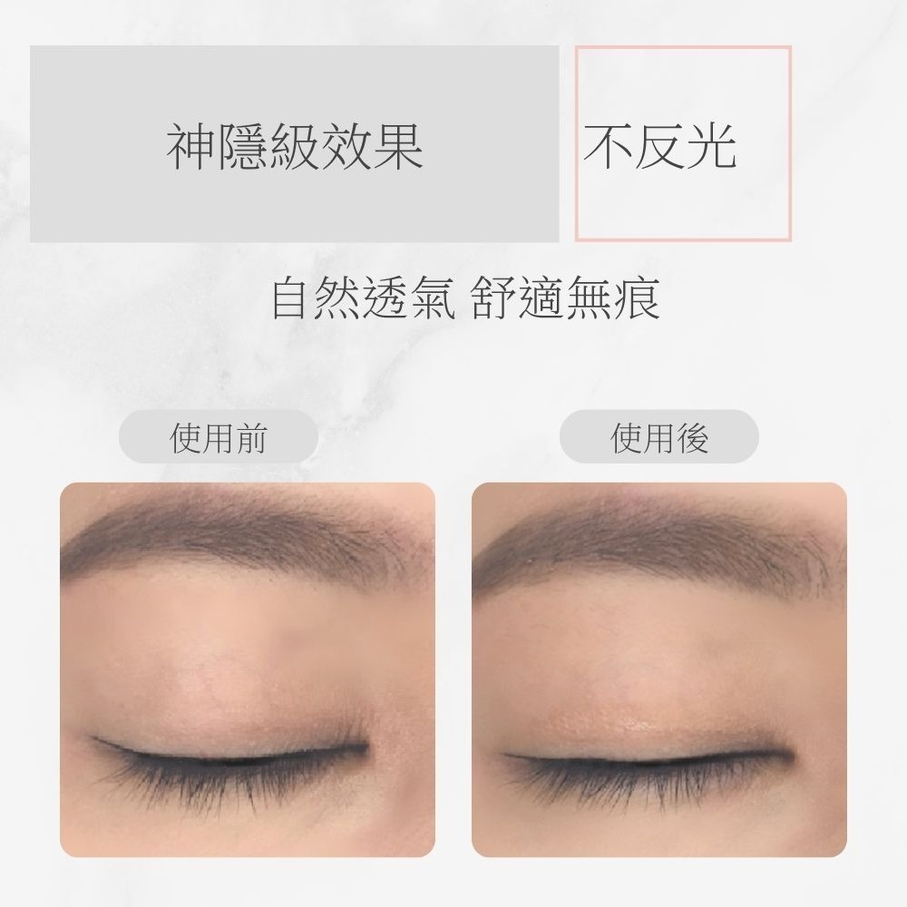 Tommy&Anson神隱系列3D雙眼皮貼～霧面蕾絲網格 自然隱形不反光 強力支撐 腫泡眼救星 台灣品牌-細節圖10