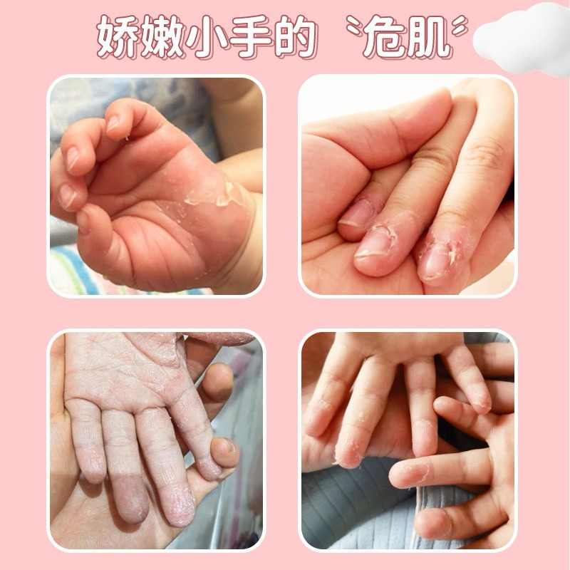 🌸兒童專用護手霜🌸幼兒嫩皮修護滋潤護手霜天然植萃溫和滋潤不刺激-細節圖2