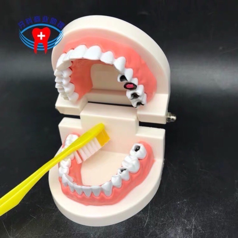 保母考試用品/兒童牙齒/六倍牙齒/二倍牙齒/齒模/1:11:1牙齒/蛀牙牙齒/矯正牙齒模型-細節圖6