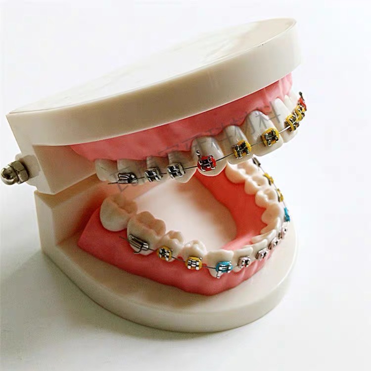 保母考試用品/兒童牙齒/六倍牙齒/二倍牙齒/齒模/1:11:1牙齒/蛀牙牙齒/矯正牙齒模型-細節圖7