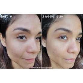 特價 倩碧CLINIQUE 勻淨白高效面膜 15ML(無盒版)-細節圖4