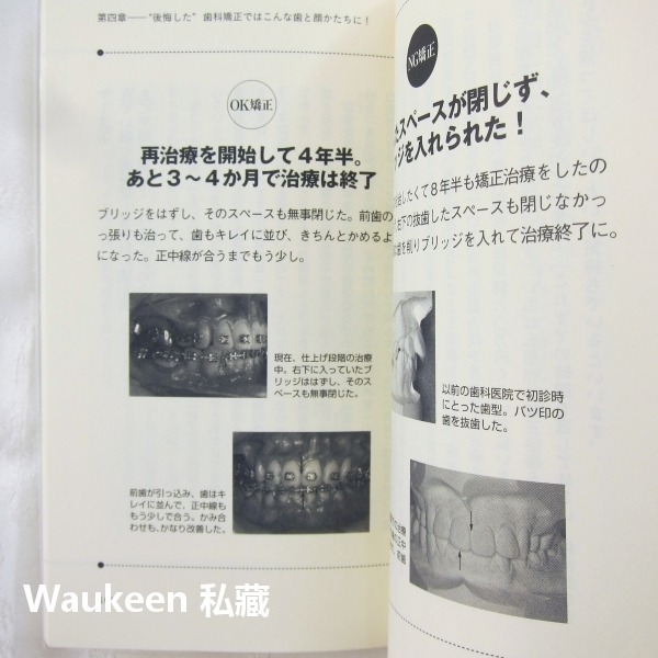 齒列矯正 後悔しない歯科矯正 増田美加 Masuda Mika 牙齒矯正 牙醫牙套 日本矯正歯科協会 健康醫學-細節圖8