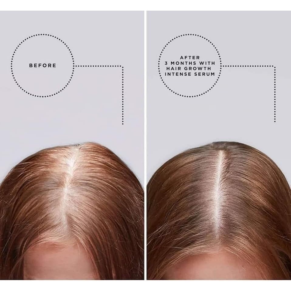 【Grow Gorgeous】生髮 精華 加強版-細節圖2