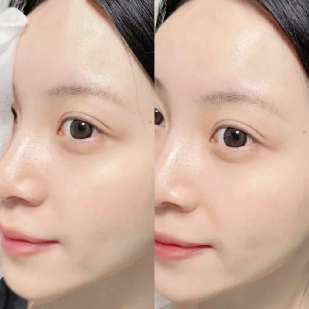 韓國【MEDIPEEL】美蒂菲 積雪草 舒緩 面膜50片/盒-細節圖3