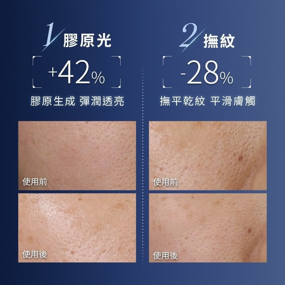 💧 【蘭蔻】｜超極限肌因精華露 150ml ✨#小黑水 效28/07-細節圖5