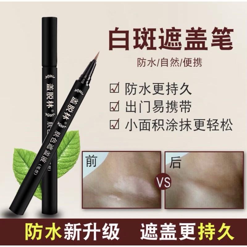 蓋脫林白斑遮蓋液筆霜防水防汗膚色外用臉部手部膏克星持久黑色素-細節圖2