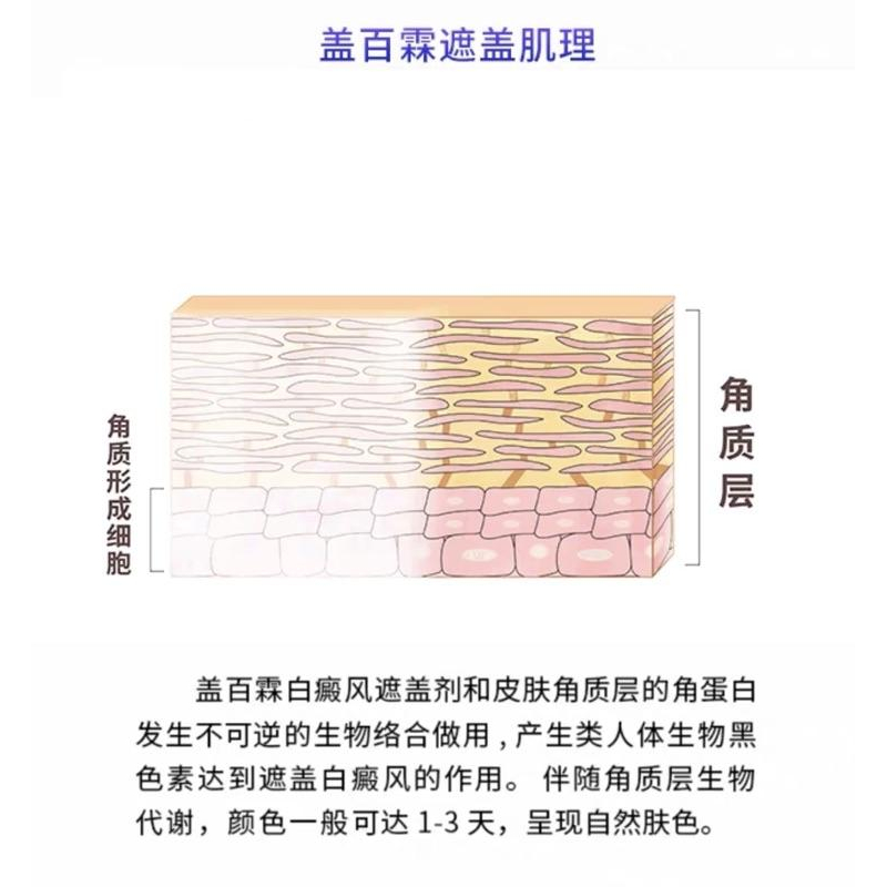 蓋百霖 白斑遮瑕筆 外出型 防水型遮蓋筆 代購-細節圖3