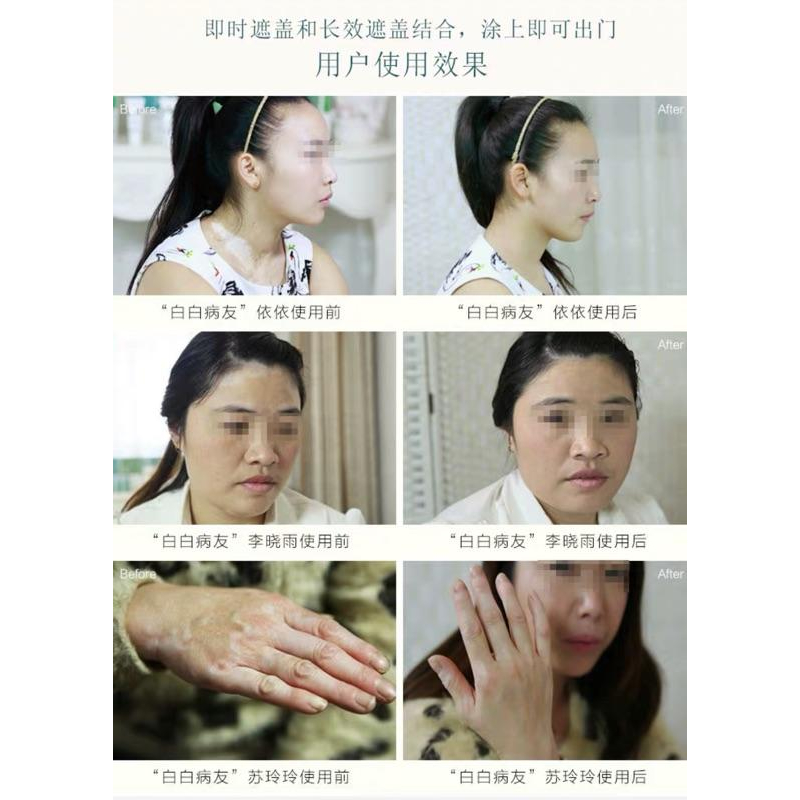 遮之防水2型 白斑遮瑕液 遮之二型 ～正品代購有防偽標籤-細節圖3