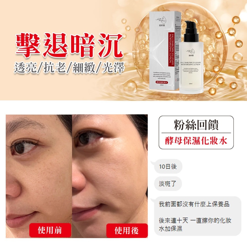 酵母保濕化妝水-細節圖9