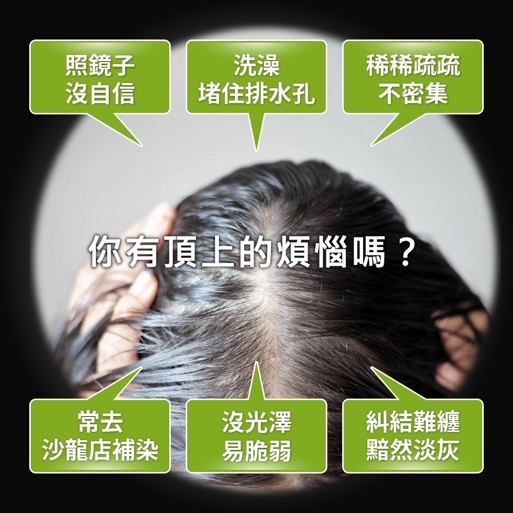 芯升髮 30顆⚜️NEW LIFE 恆黑養護膠囊 專利PHB複方濃縮粉 保加利亞乳酸桿菌 美國諾貝爾胜肽技術 足量添加-細節圖2