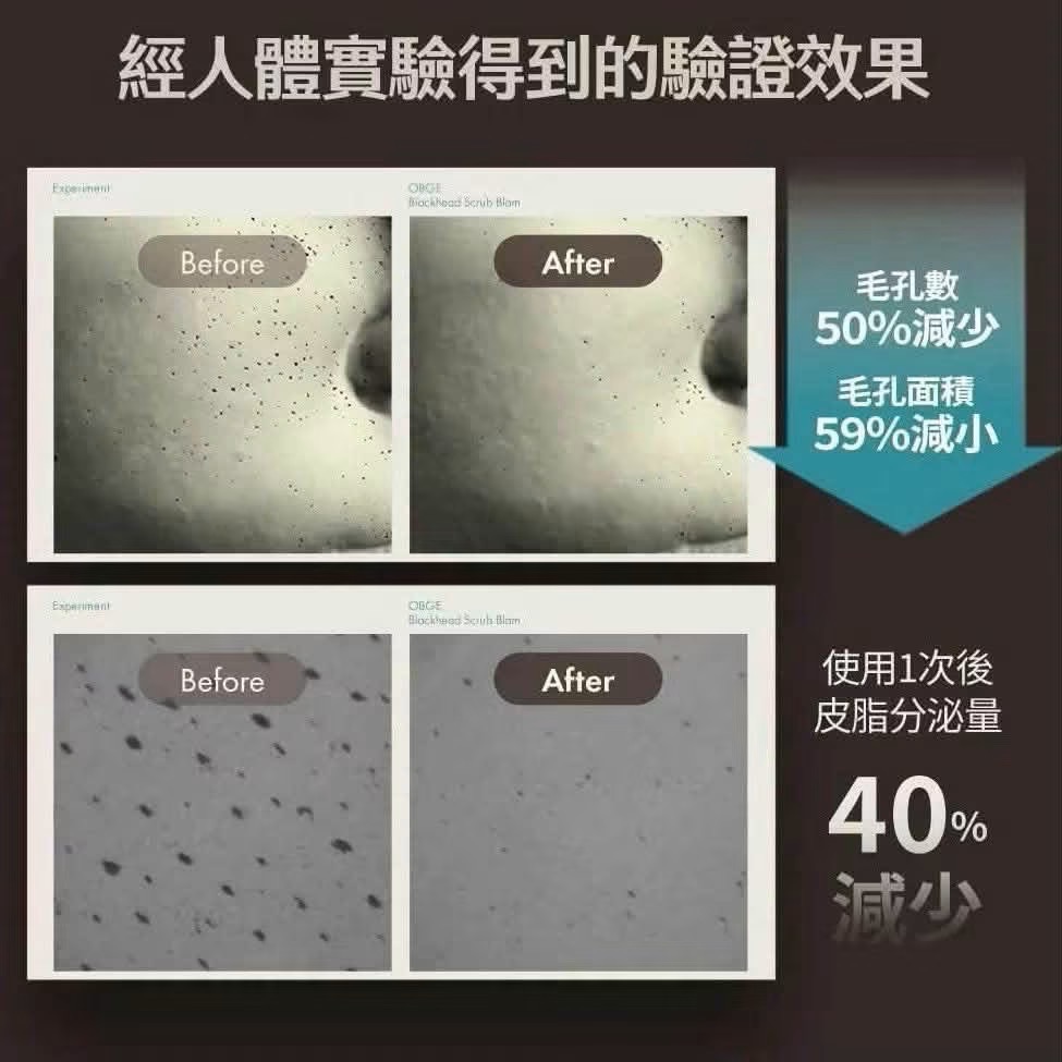 韓國 OBgE 茶樹控油去黑頭清潔棒 20g （預購）-細節圖5