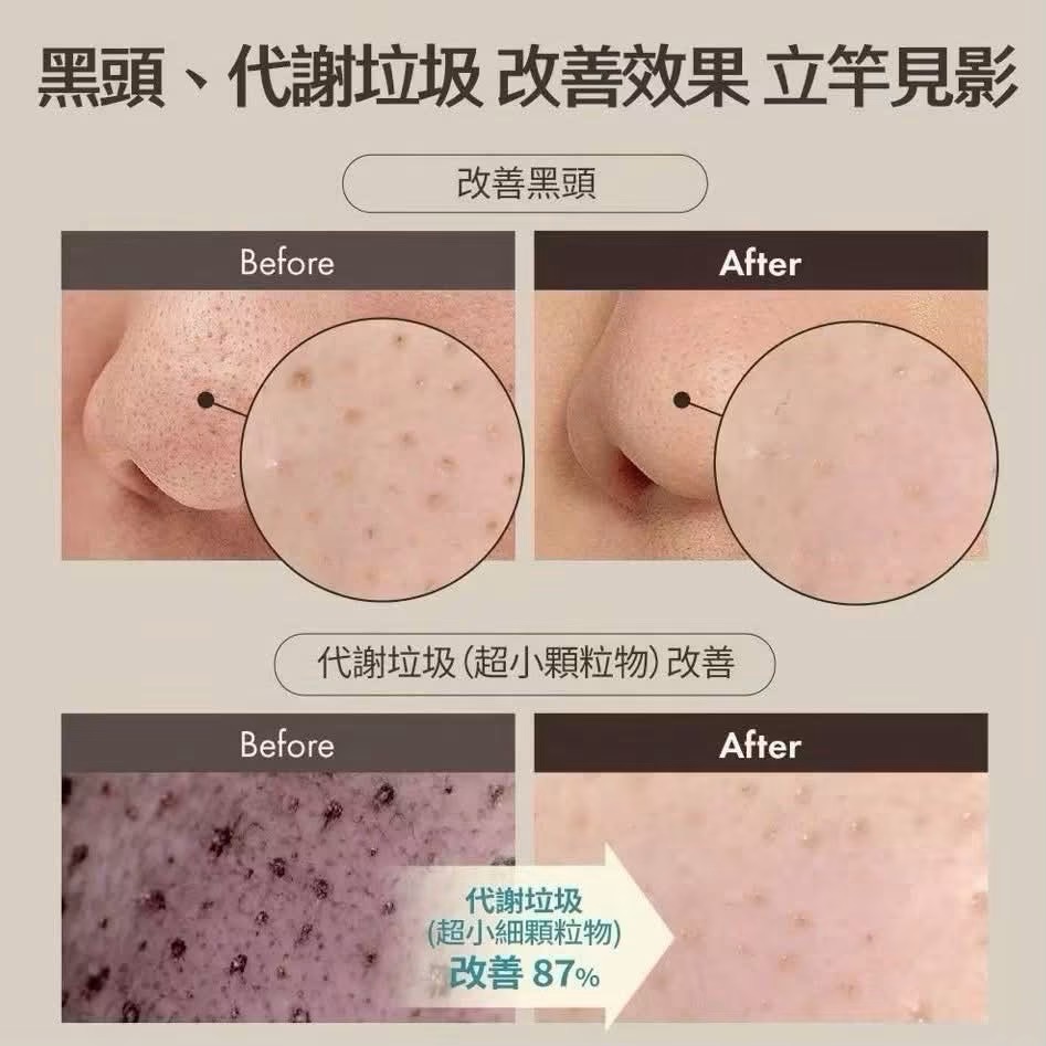 韓國 OBgE 茶樹控油去黑頭清潔棒 20g （預購）-細節圖6