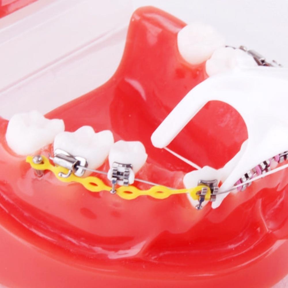 韓國 WEDENT 威登 成人攜帶式牙線棒(直式)(顏色隨機) 矯正牙齒者適用 薄荷 木醣醇 環保 可替換-細節圖3