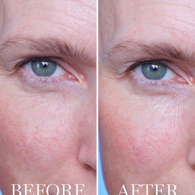 預購#Lancome 蘭蔻 超未來肌因亮眼精粹霜15ml-細節圖3