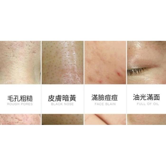 梵貞玻尿酸保濕滋潤面霜，密集補水，水潤細膩柔滑男女面霜（50g）H01-細節圖3