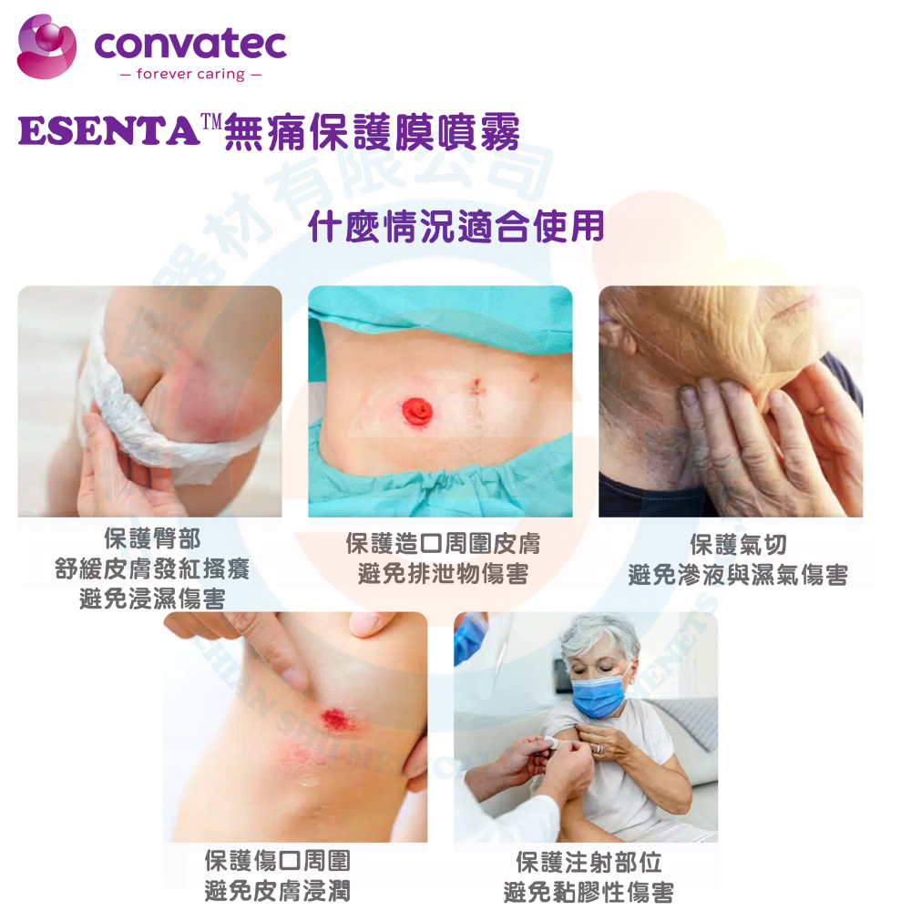 ConvaTec 康威 ESENTA 無痛保護膜噴霧 失禁隔離 不含酒精 低敏 保護噴霧 長效保護 英國原裝進口-細節圖5