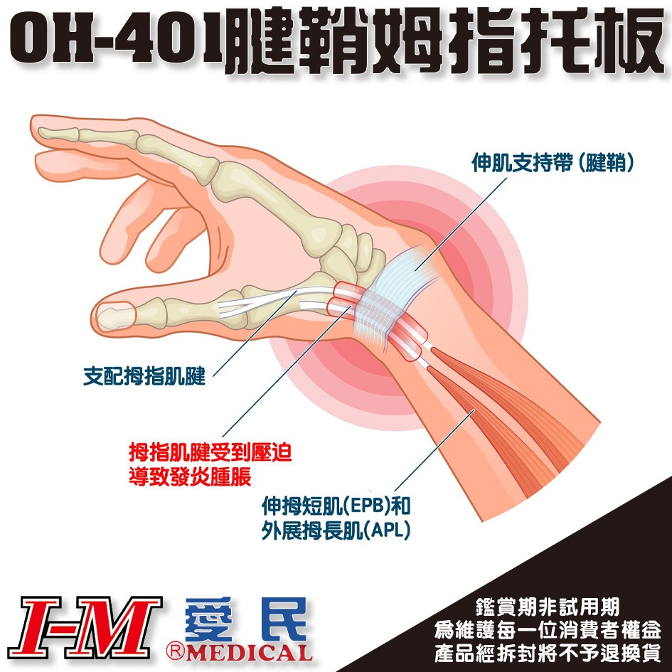 I-M 愛民 OH-401 腱鞘炎拇指托板 護具 護手指 拇指托板 腱鞘炎 手指固定 醫療護具 職業護具 台灣製造-細節圖2