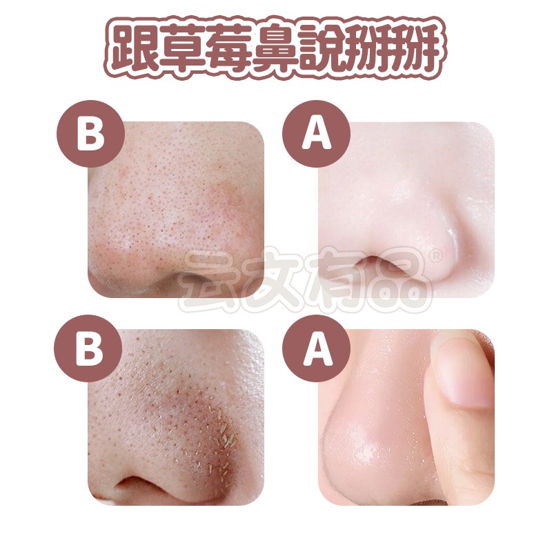 黑頭鼻膜膏👍全臉可用 除黑頭鼻貼 收縮毛孔 粉刺護理 消除草莓鼻 撕拉鼻膜 CY276 粉刺 毛孔清潔 去粉刺 本原-細節圖5